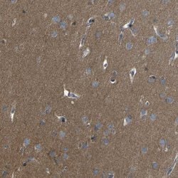 Invitrogen LRRN1 Polyclonal Antibody 100 &mu;L; Unconjugated:Antibodies,