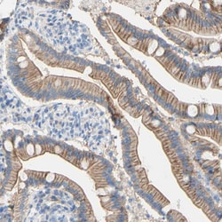 Invitrogen TMIGD2 Polyclonal Antibody 100 &mu;L | Buy Online | Invitrogen&trade; | Fisher Scientific