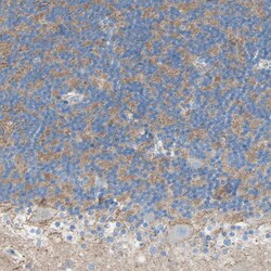 Invitrogen TMIGD2 Polyclonal Antibody 100 &mu;L | Buy Online | Invitrogen&trade; | Fisher Scientific