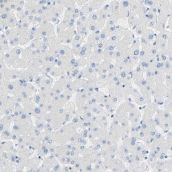 Invitrogen TMIGD2 Polyclonal Antibody 100 &mu;L | Buy Online | Invitrogen&trade; | Fisher Scientific