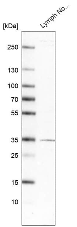 Invitrogen TMIGD2 Polyclonal Antibody 100 &mu;L | Buy Online | Invitrogen&trade; | Fisher Scientific