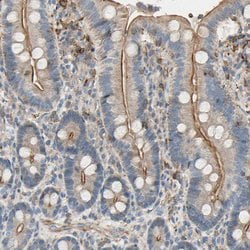 Invitrogen SEMA4C Polyclonal Antibody 100 &mu;L; Unconjugated:Antibodies,
