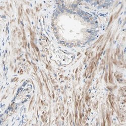 Invitrogen SEMA4C Polyclonal Antibody 100 &mu;L; Unconjugated:Antibodies,