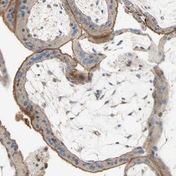 Invitrogen SEMA4C Polyclonal Antibody 100 &mu;L; Unconjugated:Antibodies,