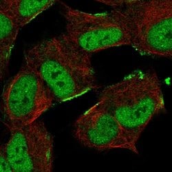 Invitrogen ZNF690 Polyclonal Antibody 100 &mu;L; Unconjugated:Antibodies,