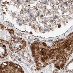 Invitrogen ZNF690 Polyclonal Antibody 100 &mu;L; Unconjugated:Antibodies,
