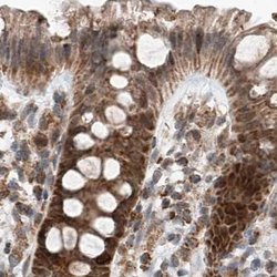 Invitrogen ZNF690 Polyclonal Antibody 100 &mu;L; Unconjugated:Antibodies,