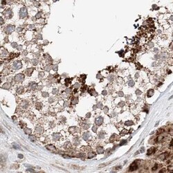 Invitrogen ZNF690 Polyclonal Antibody 100 &mu;L; Unconjugated:Antibodies,
