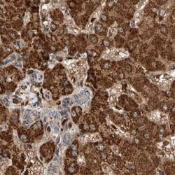 Invitrogen ZNF690 Polyclonal Antibody 100 &mu;L; Unconjugated:Antibodies,