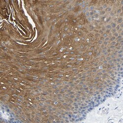 Invitrogen DYNAP Polyclonal Antibody 100 &mu;L; Unconjugated:Antibodies,
