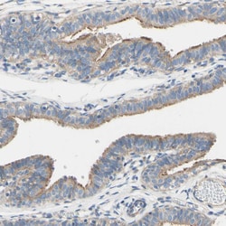 Invitrogen FAM134A Polyclonal Antibody 100 &mu;L | Buy Online | Invitrogen&trade; | Fisher Scientific