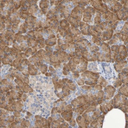 Invitrogen SRPRB Polyclonal Antibody 100 &mu;L | Buy Online | Invitrogen&trade; | Fisher Scientific