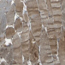 Invitrogen NEXN Polyclonal Antibody 100 &mu;L | Buy Online | Invitrogen&trade; | Fisher Scientific