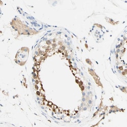 Invitrogen FGF4 Polyclonal Antibody 100 &mu;L; Unconjugated:Antibodies,
