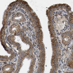 Invitrogen TRAP alpha Polyclonal Antibody 100 &mu;L; Unconjugated:Antibodies,