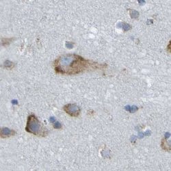 Invitrogen TRAP alpha Polyclonal Antibody 100 &mu;L; Unconjugated:Antibodies,