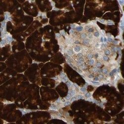 Invitrogen TRAP alpha Polyclonal Antibody 100 &mu;L; Unconjugated:Antibodies,
