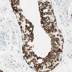 Invitrogen FMR1NB Polyclonal Antibody 100 &mu;L; Unconjugated:Antibodies,