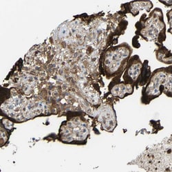 Invitrogen C1GALT1 Polyclonal Antibody 100 &mu;L; Unconjugated:Antibodies,
