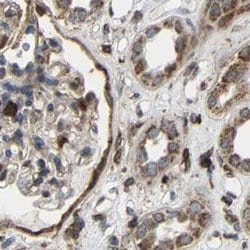 Invitrogen C1GALT1 Polyclonal Antibody 100 &mu;L; Unconjugated:Antibodies,