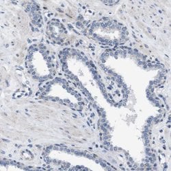Invitrogen ZP2 Polyclonal Antibody 100 &mu;L; Unconjugated:Antibodies,