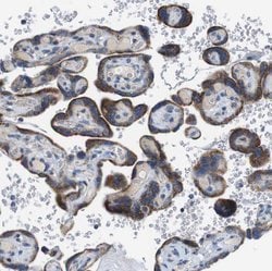 Invitrogen ZP2 Polyclonal Antibody 100 &mu;L; Unconjugated:Antibodies,