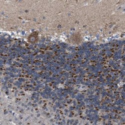 Invitrogen ZP2 Polyclonal Antibody 100 &mu;L; Unconjugated:Antibodies,