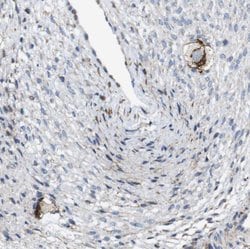 Invitrogen ZP2 Polyclonal Antibody 100 &mu;L; Unconjugated:Antibodies,