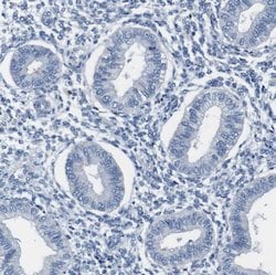 Invitrogen ZP2 Polyclonal Antibody 100 &mu;L; Unconjugated:Antibodies,