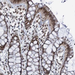 Invitrogen Cdc5L Polyclonal Antibody 100 &mu;L; Unconjugated:Antibodies,