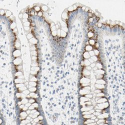 Invitrogen B4GALNT3 Polyclonal Antibody 100 &mu;L; Unconjugated:Antibodies,