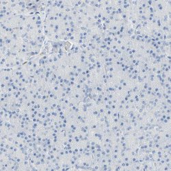 Invitrogen B4GALNT3 Polyclonal Antibody 100 &mu;L; Unconjugated:Antibodies,