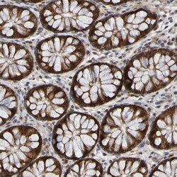 Invitrogen CCDC51 Polyclonal Antibody 100 &mu;L; Unconjugated:Antibodies,