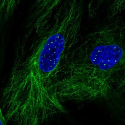 Invitrogen KCNE4 Polyclonal Antibody 100 &mu;L; Unconjugated:Antibodies,