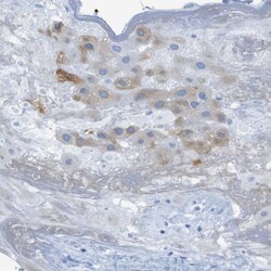 Invitrogen ERVMER34-1 Polyclonal Antibody 100 &mu;L; Unconjugated:Antibodies,