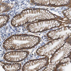 Invitrogen ERVMER34-1 Polyclonal Antibody 100 &mu;L; Unconjugated:Antibodies,