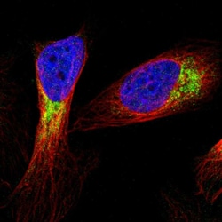 Invitrogen MTX1 Polyclonal Antibody 100 &mu;L; Unconjugated:Antibodies,