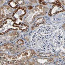 Invitrogen MTX1 Polyclonal Antibody 100 &mu;L; Unconjugated:Antibodies,