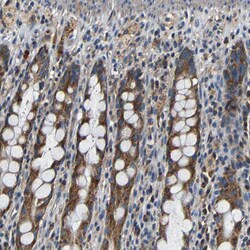 Invitrogen MTX1 Polyclonal Antibody 100 &mu;L; Unconjugated:Antibodies,