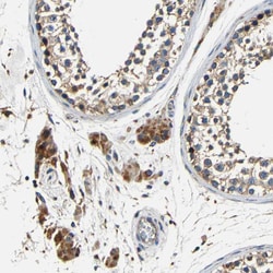 Invitrogen MTX1 Polyclonal Antibody 100 &mu;L; Unconjugated:Antibodies,