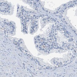 Invitrogen KIAA1024 Polyclonal Antibody 100 &mu;L; Unconjugated:Antibodies,