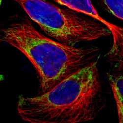 Invitrogen TOMM20 Polyclonal Antibody 100 &mu;L; Unconjugated:Antibodies,