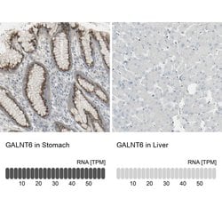Invitrogen GALNT6 Polyclonal Antibody 100 &mu;L; Unconjugated:Antibodies,