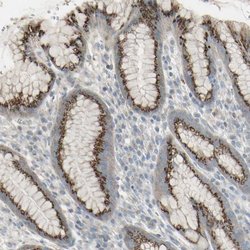 Invitrogen GALNT6 Polyclonal Antibody 100 &mu;L; Unconjugated:Antibodies,