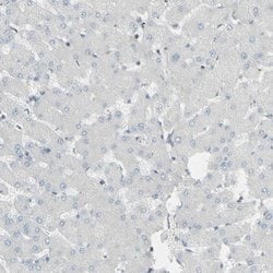 Invitrogen GALNT6 Polyclonal Antibody 100 &mu;L; Unconjugated:Antibodies,