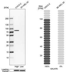 Invitrogen GALNT6 Polyclonal Antibody 100 &mu;L; Unconjugated:Antibodies,