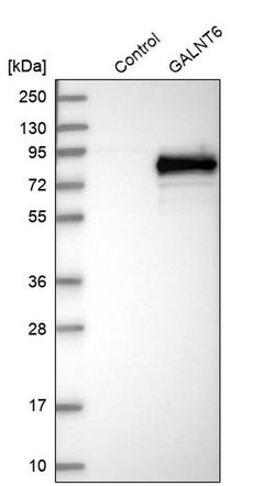Invitrogen GALNT6 Polyclonal Antibody 100 &mu;L; Unconjugated:Antibodies,