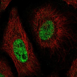 Invitrogen CNTNAP1 Polyclonal Antibody 100 &mu;L; Unconjugated:Antibodies,