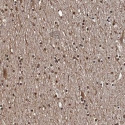 Invitrogen SEZ6 Polyclonal Antibody 100 &mu;L; Unconjugated:Antibodies,