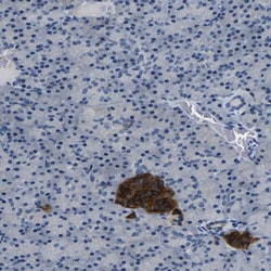 Invitrogen FAM159B Polyclonal Antibody 100 &mu;L | Buy Online | Invitrogen&trade; | Fisher Scientific